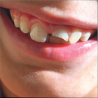 Swimming Paul — Smiling Through The Pain LP 2x12" vinyl cover