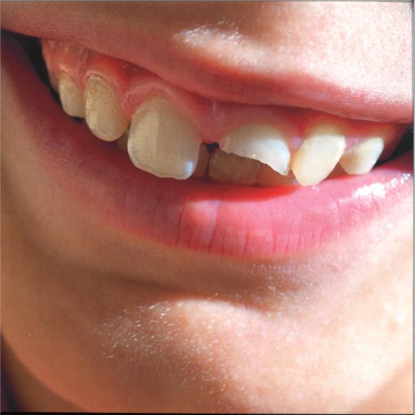 Swimming Paul — Smiling Through The Pain LP 2x12" vinyl cover