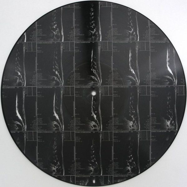 G76 — L5S1 vinyl cover