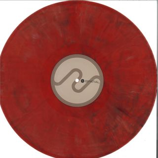 Aural Imbalance