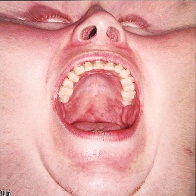 Cucumb45 — Slother EP1 vinyl cover