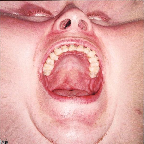 Cucumb45 — Slother EP1 vinyl cover